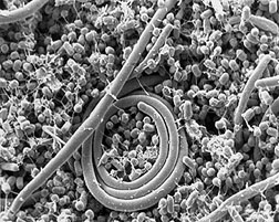 Salmonella Enteritidis Salmonella Enteritidis