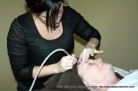 Sue Culverhouse undergoing the microderm abrasion proceedure