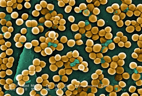 MRSA infections occur most frequently among persons in hospitals and healthcare facilities, including nursing homes, and dialysis centers. (Janice Haney Car/CDC).