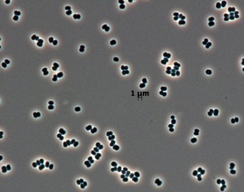 This microscopic image shows dozens of individual bacterial cells of the recently discovered species Tersicoccus phoenicis. This species has been found in only two places: clean rooms in Florida and South America where spacecraft are assembled for launch. Spacecraft clean rooms are one of the most thoroughly checked environments on Earth for what microbes are present. (NASA/JPL-Caltech)