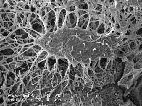 A close-up of mouse osteocytes within the bone. (Dr. L Bonewald)