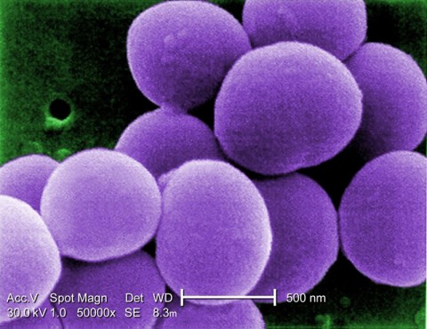 Superbugs are strains of bacteria that are resistant to several types of antibiotics. Superbugs are strains of bacteria that are resistant to several types of antibiotics.