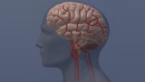 Doctors may consider administering clot-busting therapy to those patients whose stroke symptoms rapidly improved before hospital arrival. (American Heart Association) Doctors may consider administering clot-busting therapy to those patients whose stroke symptoms rapidly improved before hospital arrival. (American Heart Association)