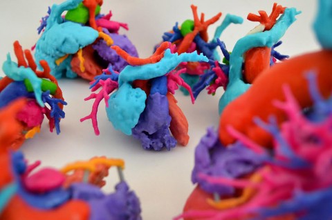 Models of multiple children’s hearts who were born with congenital heart defects, used for surgical planning. (Cardiac 3D Print Lab, Phoenix Children’s Hospital Heart Center)
