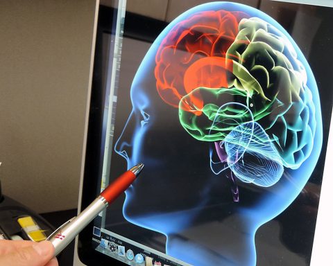 Doctor reviewing brain image up close. (American Heart Association)