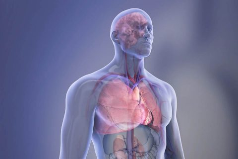 Several papers in a special issue of Circulation offer insight into how autopsy contributes to answers about the causes of sudden cardiac death, information from implantable device to improve heart function, and identifying the original cause of atherosclerosis. (American Heart Association)