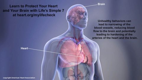 Learn to Protect Your Heart and Your Brain with Life’s Simple 7 at www.heart.org/mylifecheck Unhealthy behaviors can lead to narrowing of the blood vessels, reducing blood flow to the brain and potentially leading to hardening of the arteries of the heart and the brain. My Life Check - Life's Simple 7. (American Heart Association)