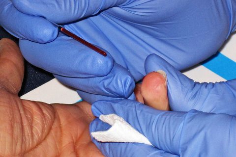 Finger prick for a cholesterol test. (American Heart Association)