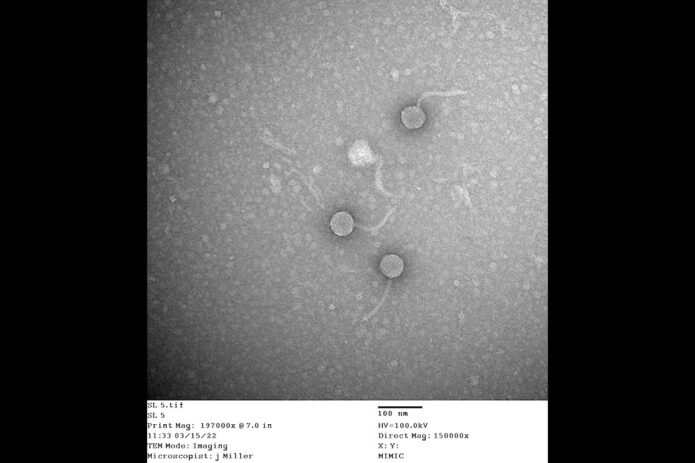 A electron microscopy photo that includes the bacteriophage Librie. (APSU)